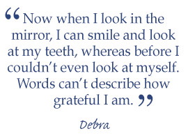 Debra's Smile Makeover Story