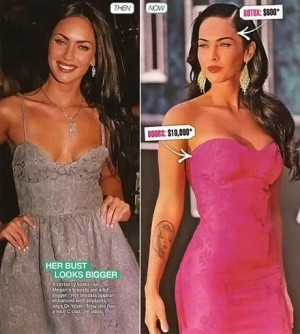 Megan Fox Plastic Surgery Before And After Botox | Nose Job | Breast ...