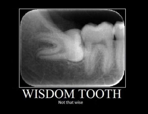 Funny Wisdom Teeth Quotes funny demotivational posters
