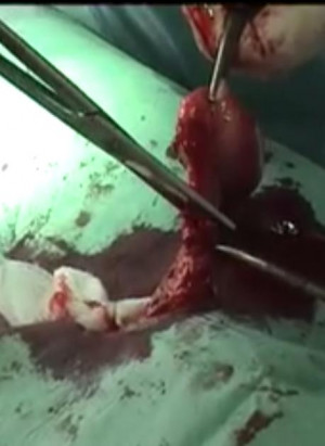 Tribes Castration Familie...