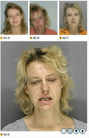 The Shocking Faces Of Drug Addiction