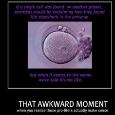 PROLIFE for my whole life!! More