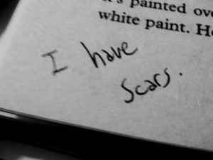 scars quotes