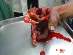 The Following 2 Users Say Thank You to BackStabber For This Useful ...