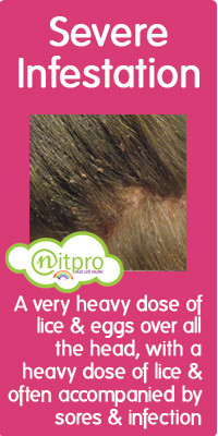 Severe Head Lice Infestation