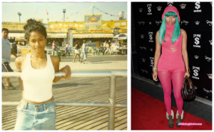 Nicki Minaj Before and After Surgery