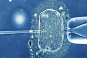 IVF - have we gone too far?