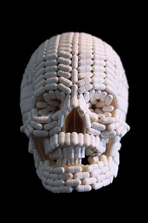 Turin Brakes – Pain Killer