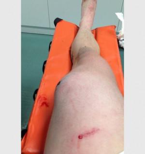 ... League Match Left A Celtic FC Player With A Disturbing Leg Injury