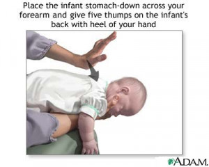... , this is a diagram on how to do the Heimlich Maneuver on an infant