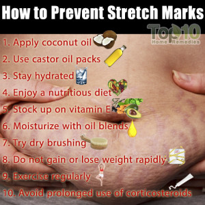 stretch marks prevention