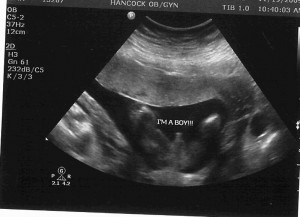 Boy Ultrasound Pregnancy