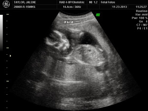 cute couple pregnancy quotes