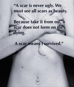We all have scars, they are beautiful.