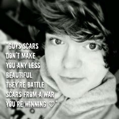 guys scars don't make you any less beautiful, they're battle scars ...
