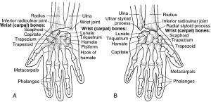 Right Hand Wrist Bones