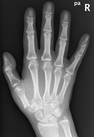 Figure 3 x ray Image