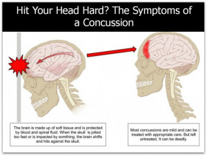... . Check these symptoms to see if you possibly have a brain injury