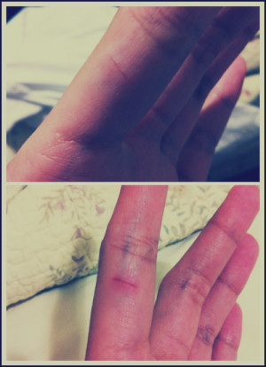 Cut Myself Tumblr Cut myself nothing serious it