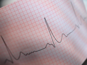Heart Rhythm Disorders and Treatments