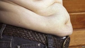 Obesity is the “single greatest” threat to health, say the doctors