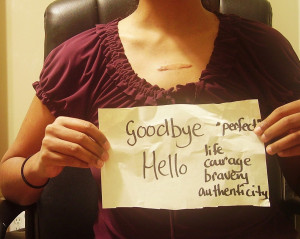 pic of me showing the keloid scar I have on my chest-no covering it ...