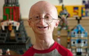 پسر 17 ساله با ظاهری 80 ساله درگذشت+عکس