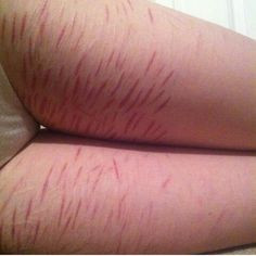 just saw this on instagram and I feel really bad for her. My legs ...