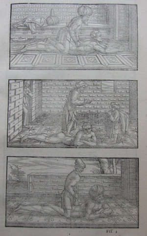 Images of physical therapy from Avicenna's Canon