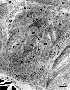 Ribosome Diagram Are Using The Computer As A Microscope