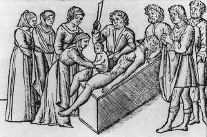 One of the earliest printed illustrations of Cesarean section ...