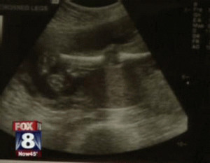 Is Abortion Murder? Is the other side trying to tell us something?