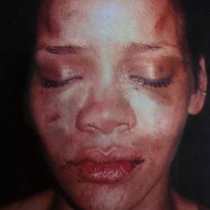 Rihanna após sofrer agressões de Chris Brown (Foto: Foto tirada pela ...
