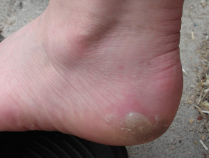 Preventing And Healing Skin...