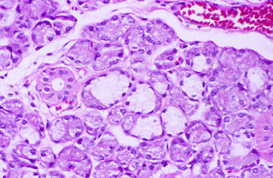 Salivary Gland Serous Demilune Histology