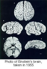 Albert Einstein’s brain weighed 1,230 grams , significantly less ...