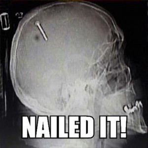 nailed it funny x rays