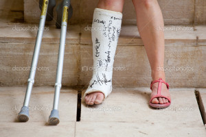 Woman with leg in plaster and crutches — Photo by bepsimage