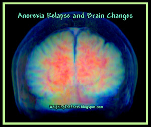 Anorexia Relapse: Study Shows Brain Changes A Factor
