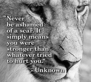 Never be ashamed of a scar. It simply means you were stronger than ...