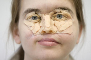 Rebuilding Chrissy's Face