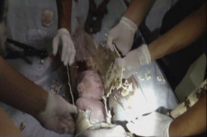 Le bébé a été sauvé par miracle. ©REUTERS/China Central ...