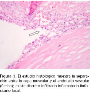 High-pitched or hissing sound, and may sound like a continuous musical ...