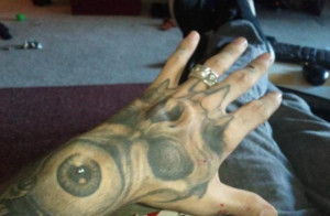 Subdermal implant in back of hand.Dermal anchor in back of wrist.