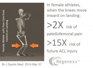 Acl Injury Causes Acl Injury Causes Acl Tear Causes Acl Knee Injury ...