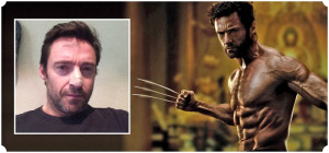 Hugh Jackman 39 s Skin Cancer