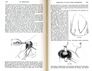 Gray's Anatomy, Descriptive and Surgical, by Henry Gray, (1862, second ...