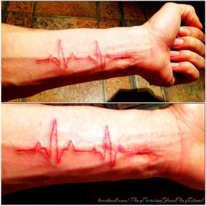 Arm scar cutting (bip... Bip...) by TheChristOff