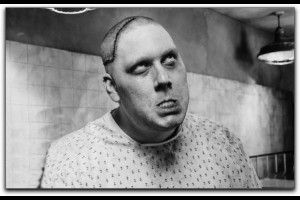 And unimproved lobotomy