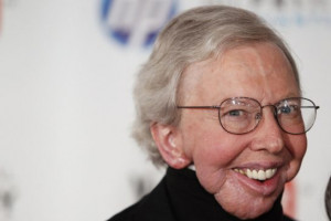 Roger Ebert was first diagnosed with papillary thyroid cancer in 2002.